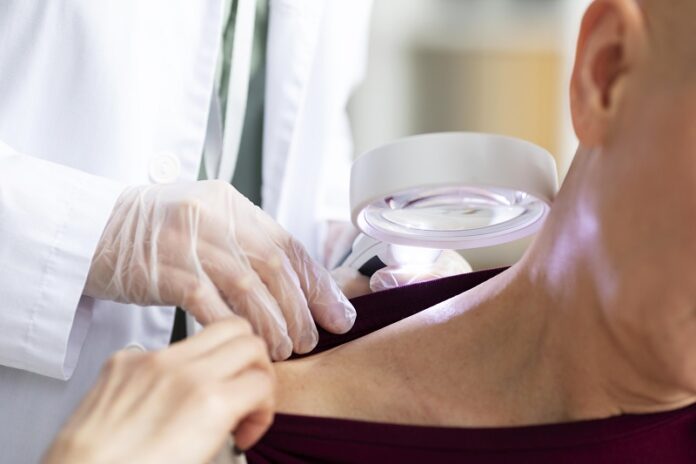 doctor doing check patient with skin cancer